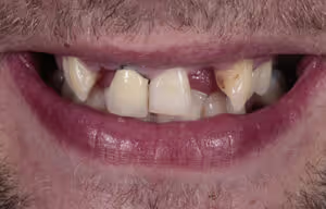 6721d5f21d1dfa0861e4fb88_Ronald-Beforepng